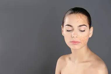 Sposoby na przesuszoną skórę - co naprawdę działa?